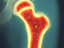 Adaptive Bone Marrow